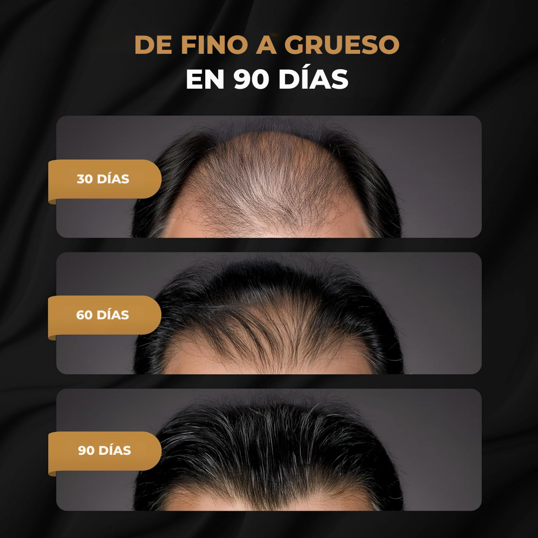 RAGNAR™ - Tratamiento Profesional Activador de Raices Capilares