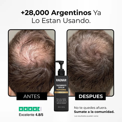 RAGNAR™ - Tratamiento Profesional Activador de Raices Capilares