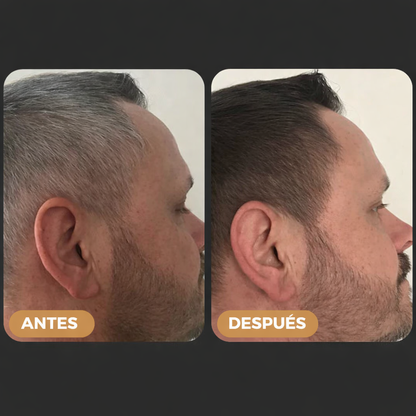 RAGNAR™ - Tratamiento Profesional Shampoo Anti Canas