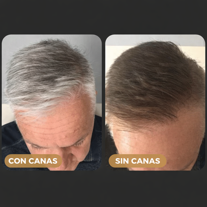 RAGNAR™ - Tratamiento Profesional Shampoo Anti Canas