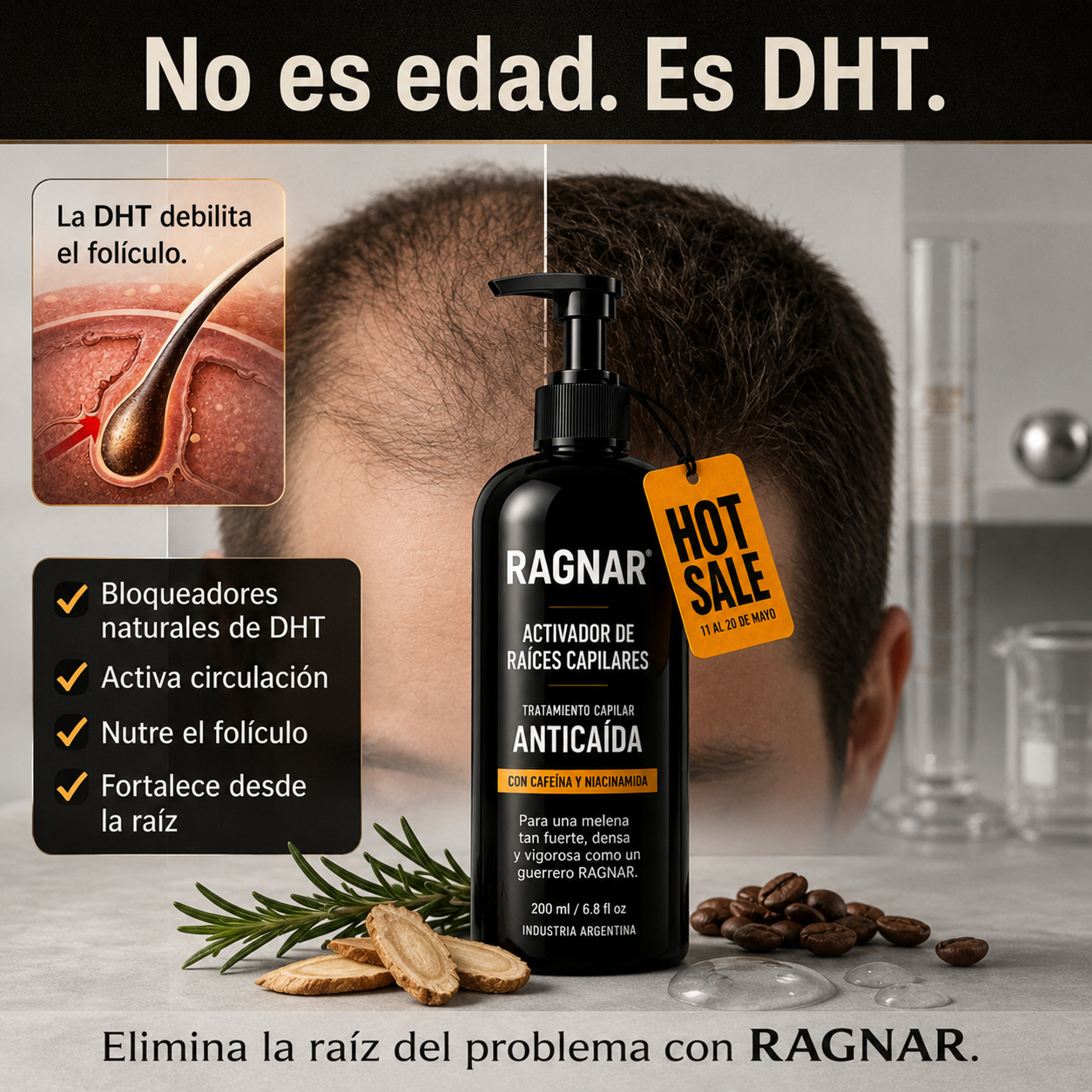 RAGNAR® - Tratamiento Profesional Activador de Raices Capilares