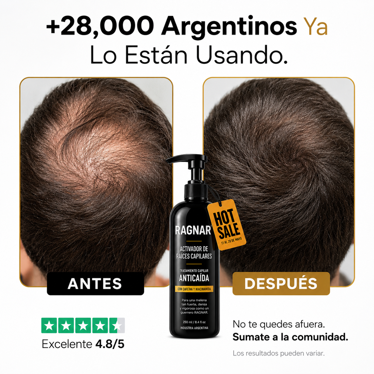 RAGNAR® - Tratamiento Profesional Activador de Raices Capilares